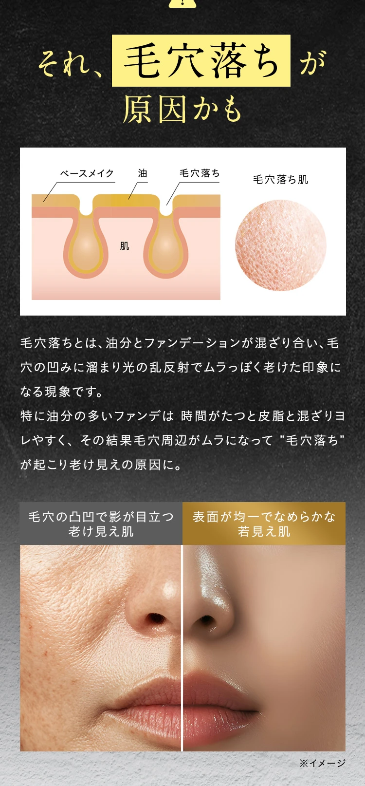 それ、毛穴落ちが原因かも