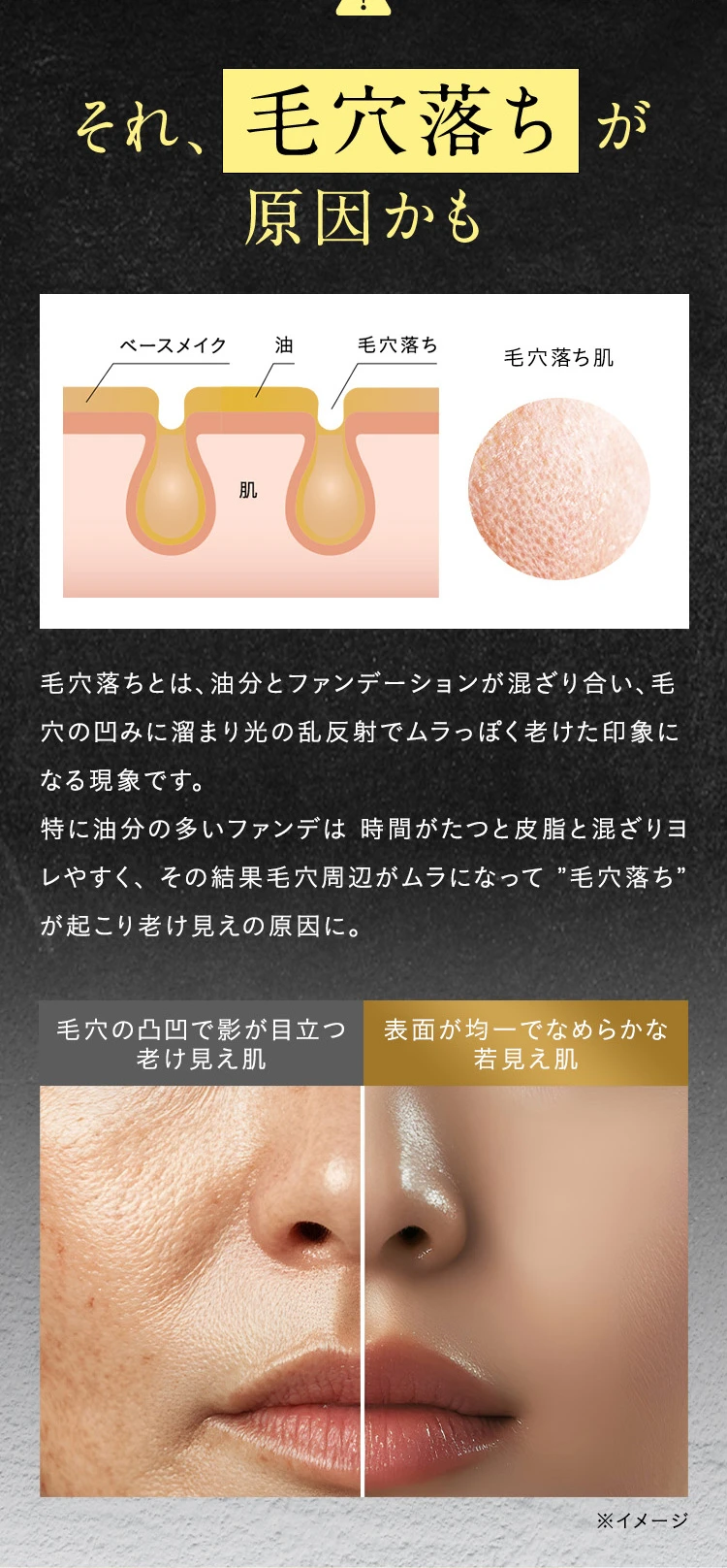 それ毛穴落ちが原因かも